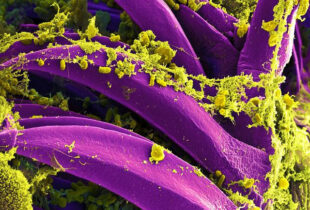 bakterija uzročnik kuge