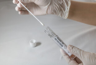 Nove cijene testiranja (PCR i brzi antigenski test) u HZJZ